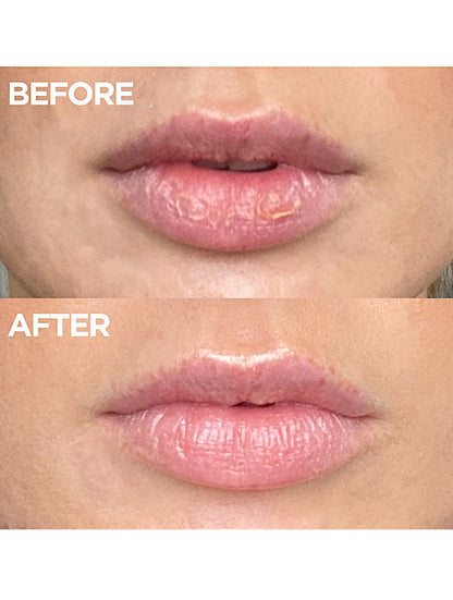 Before and after close up of lips showing the visible results of Lanolips 101 Ointment made with 100% ultra-pure grade lanolin. The top image displays dry, flaky lips, while the bottom shows visibly softer, smoother, and glossier lips, highlighting intense hydration and repair.